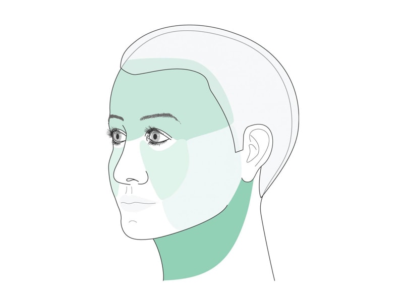 Bei der Gesichtsstraffung wird eine Unterteilung des Gesichtes in vier Partien Stirn, Mittelgesicht, Hals und Wangen vorgenommen.