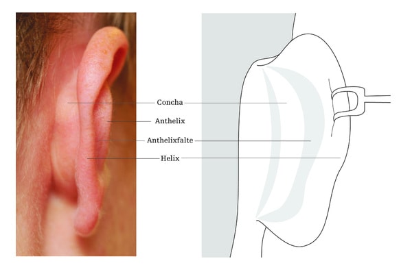 Ohrenkorrektur Wien Abstehende Ohren Dr Turkof.