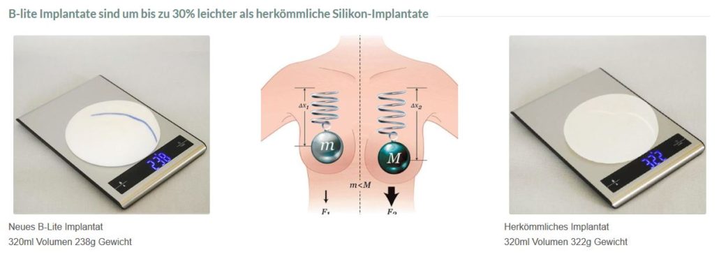 Vergleich Leicht Brust Implantat - Wien