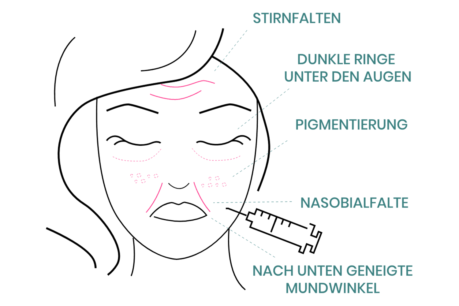 Die Vorteile einer Behandlung im Gesicht