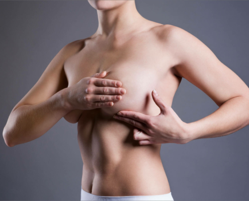 Brustvergrößerung mit B-lite Leichtimplantaten