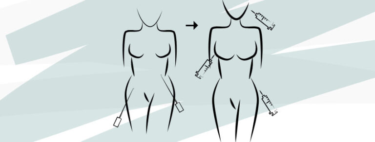 Illustration der Eigenfetttransplantation an weiblicher Brust und Hüfte.