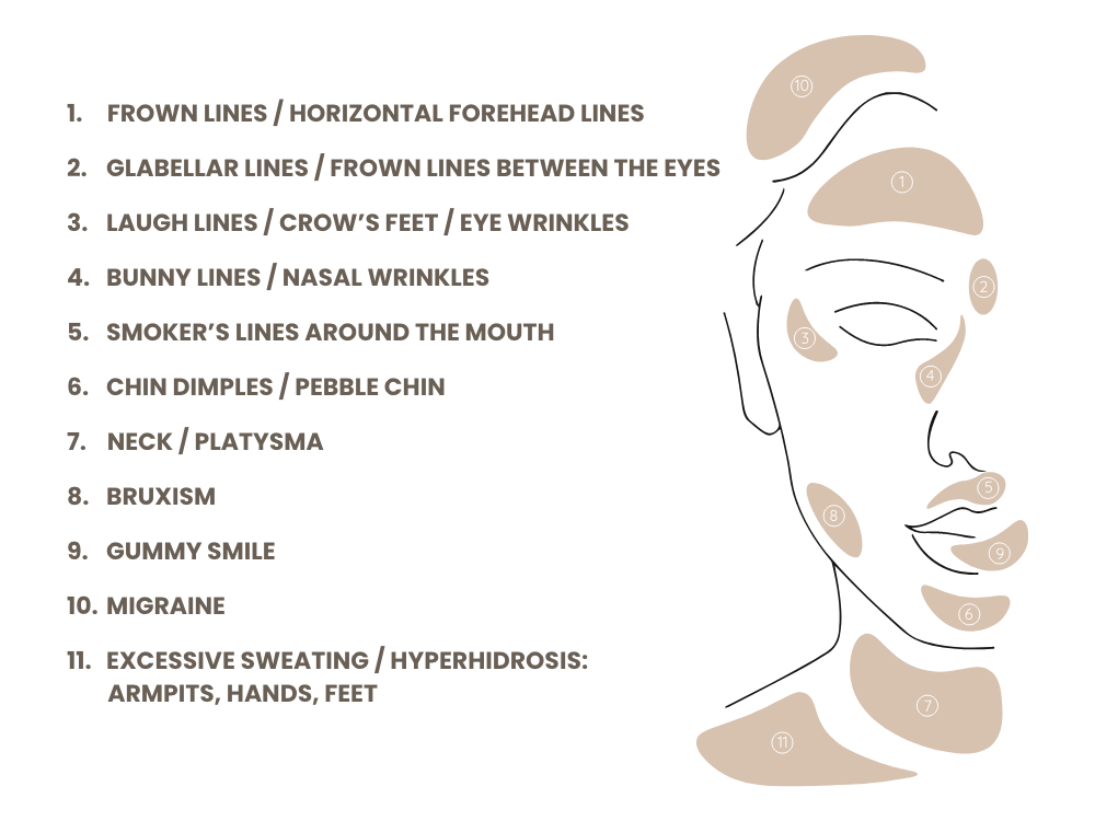 botox-regionen