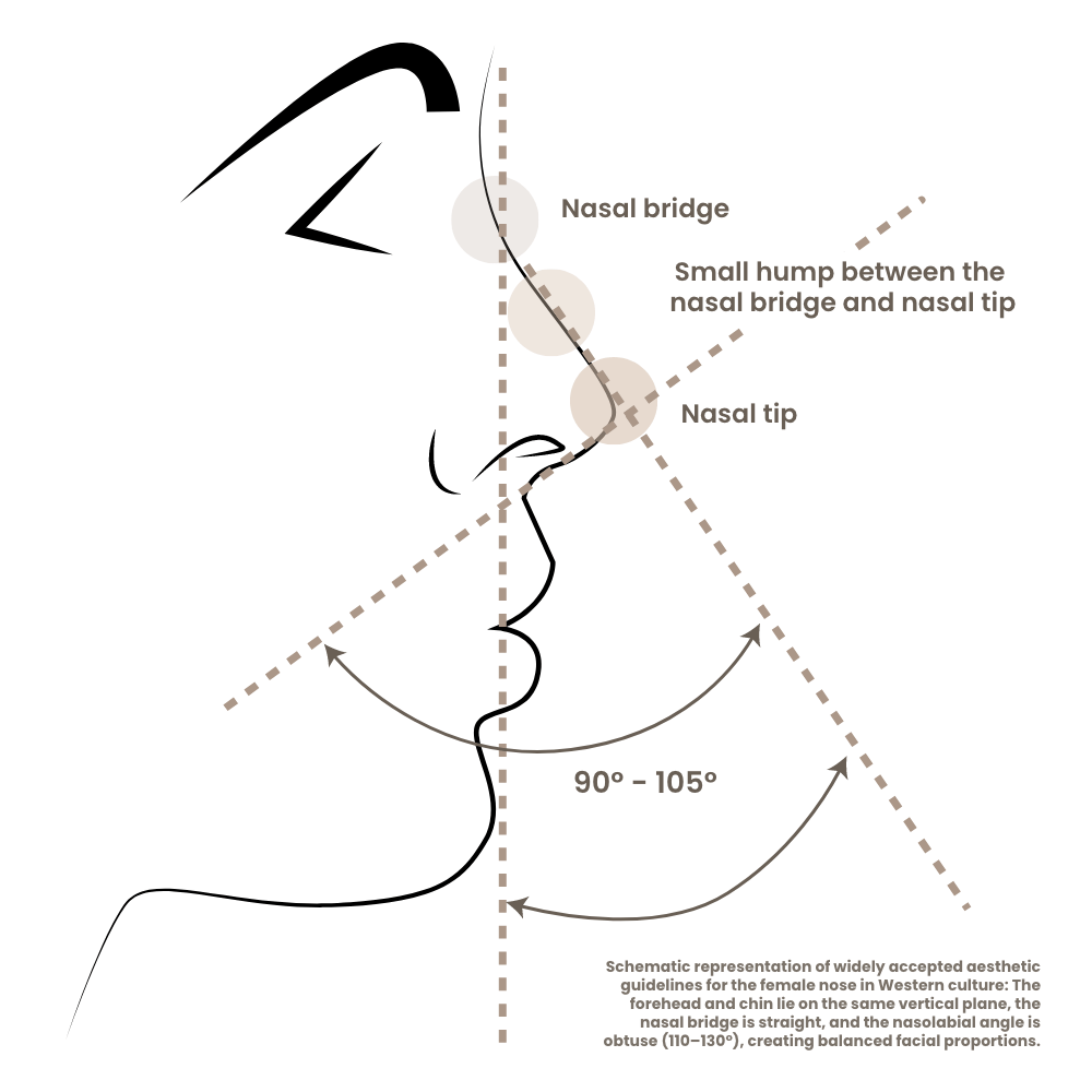 nasenkorrektur-schema