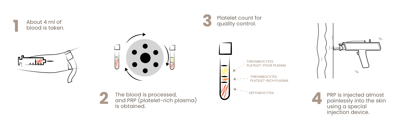 vampirelift-methode-turkof-3