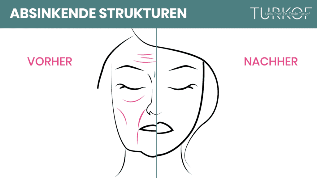 Video-Vorschaubild