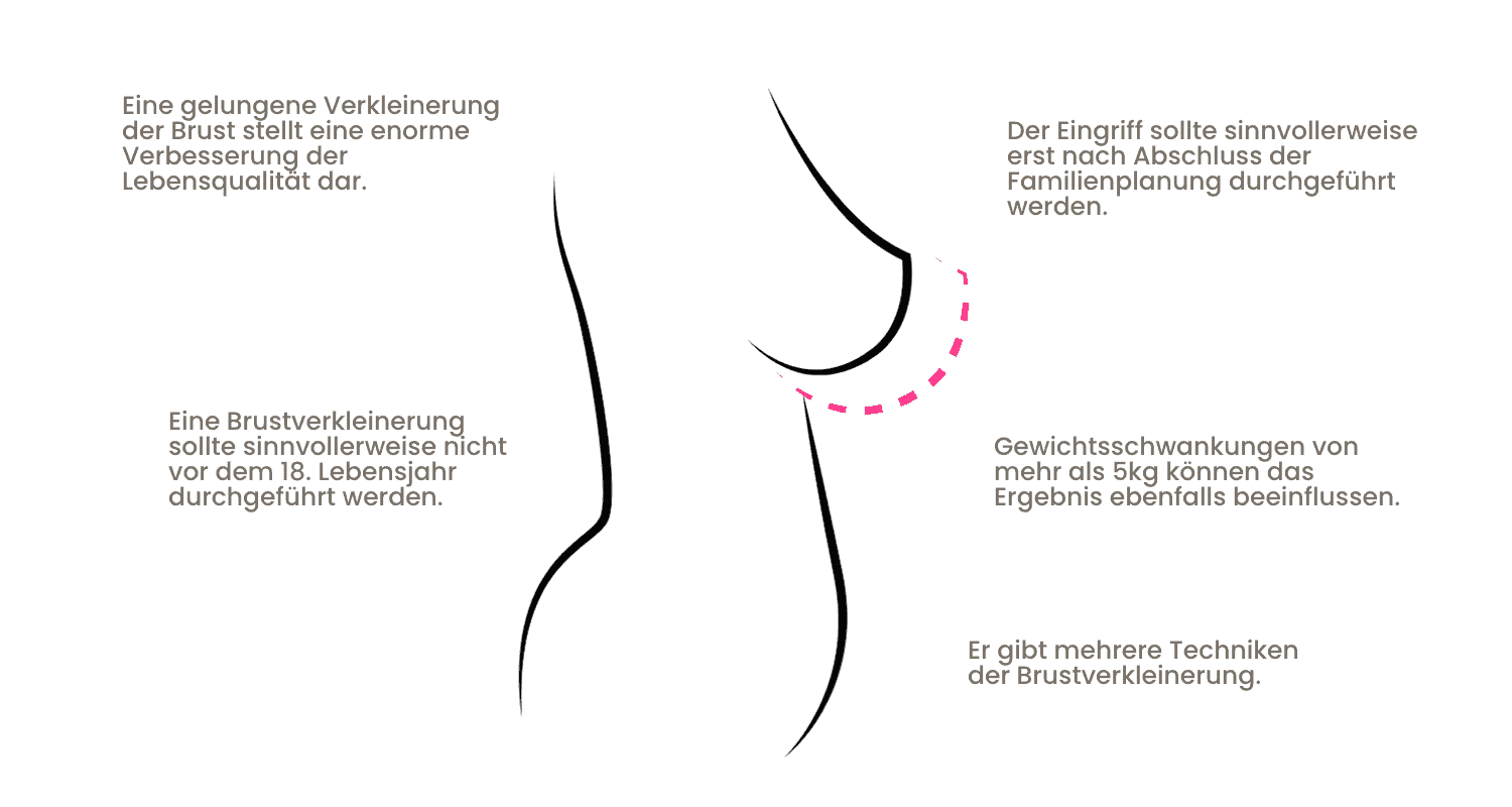 Illustration zur Brustverkleinerung mit Tipps und Techniken für eine schöne Silhouette.