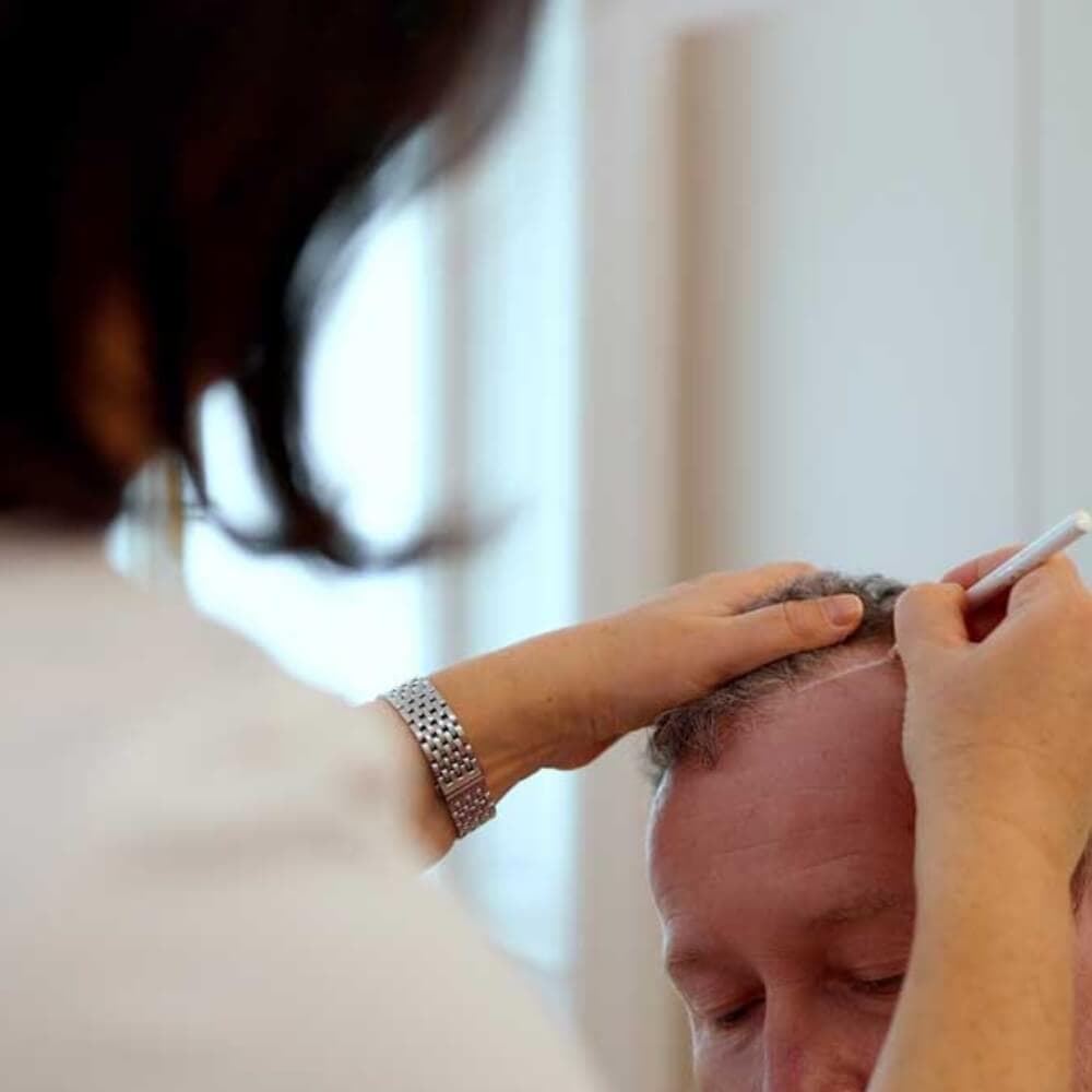 Hautarzt prüft Kopfhaut eines Mannes mit einem Stift.