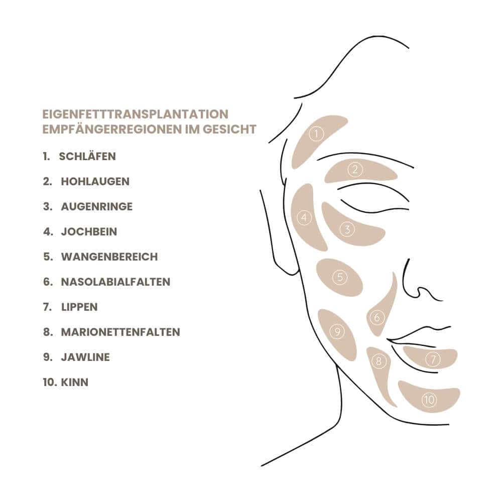 Gesicht mit markierten Bereichen für Hautanalyse nach Transplantation.
