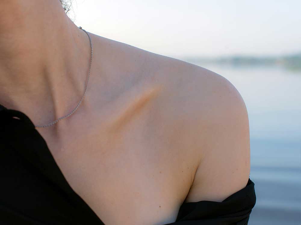 Nervenrekonstruktionen