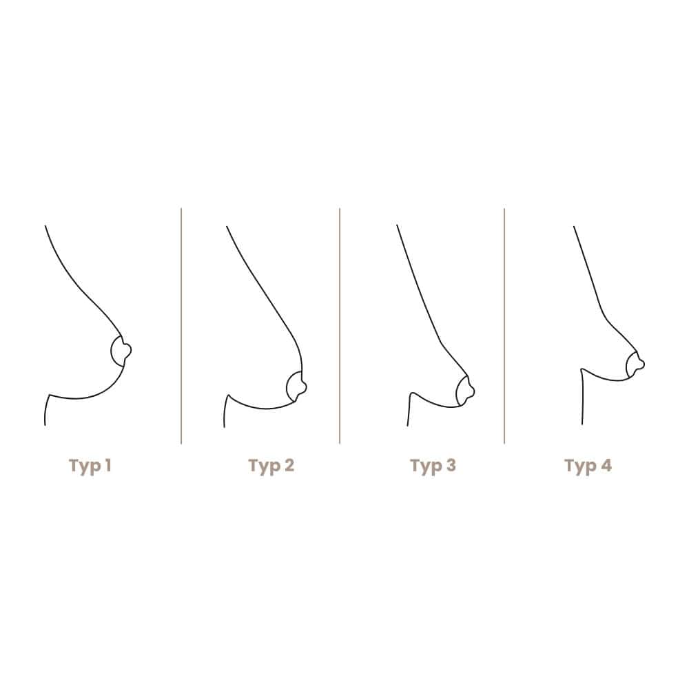 Diagramm zeigt vier Brusttypen mit unterschiedlichen Konturen und Formen.