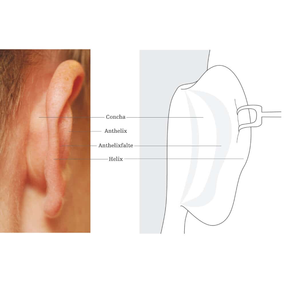 Hörgerät im Ohr mit anatomischer Darstellung der Ohrteile.