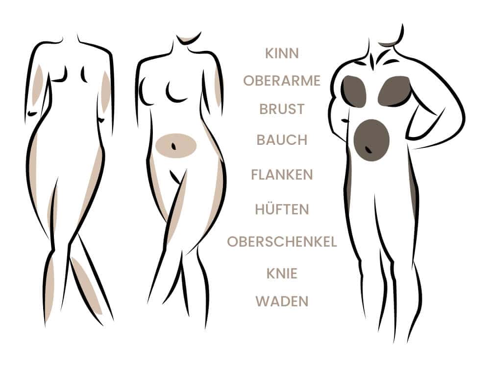 Körperstellen für medizinische oder kosmetische Behandlungen.