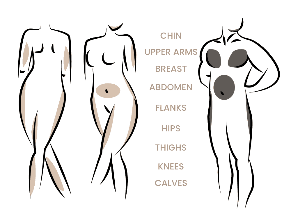 Anatomische Körperzonen bei Frauen und Männern, inklusive Brust, Bauch und Beine.