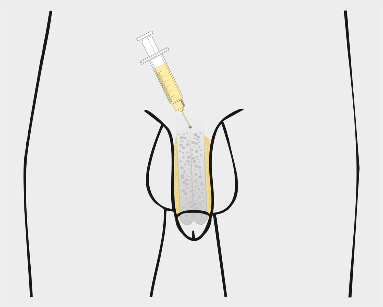 Hodeninjektion mit Spritze in männliches Tier, medizinische Behandlung.