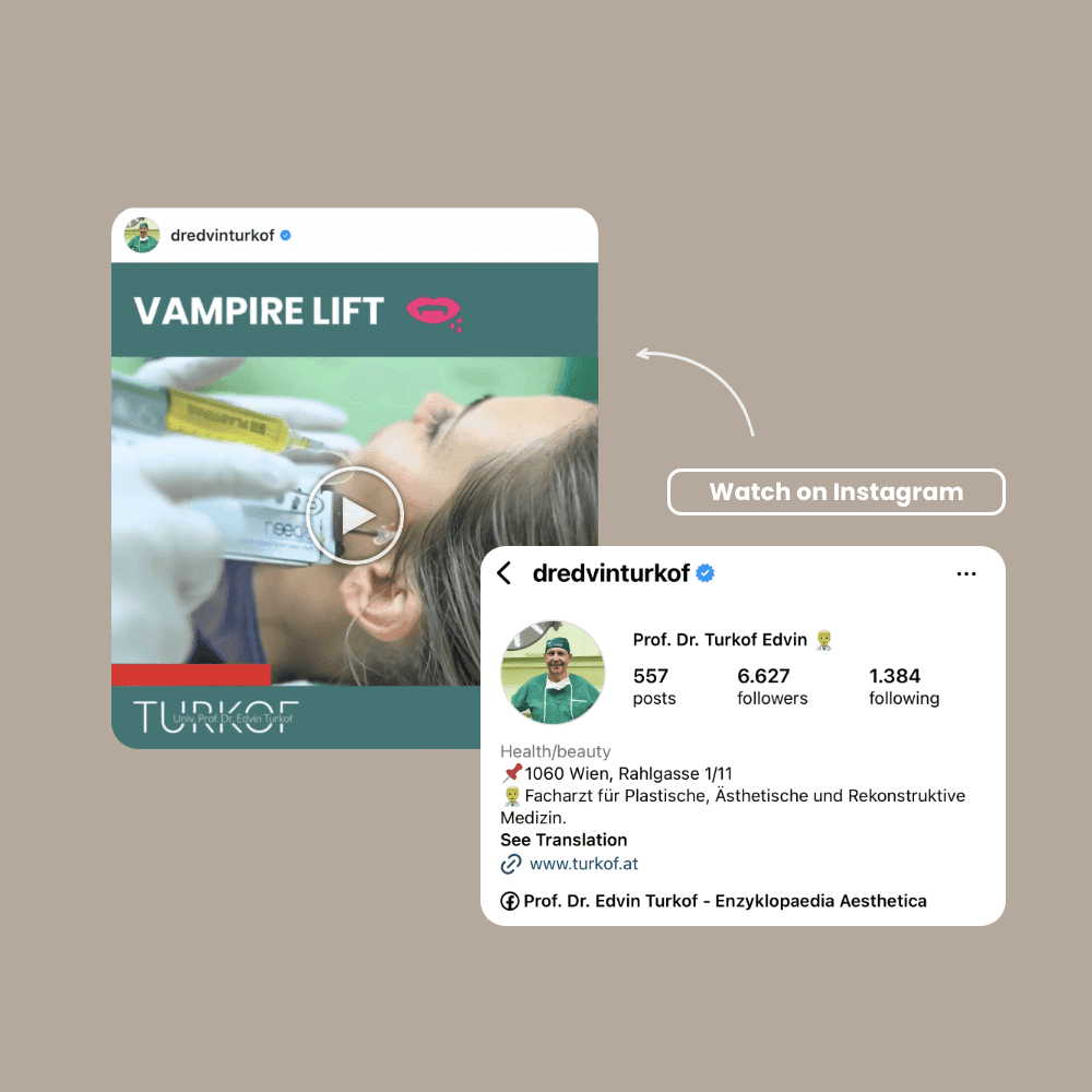 Medizinischer Vampirlift bei Turkof für ästhetische Gesichtsbehandlung.