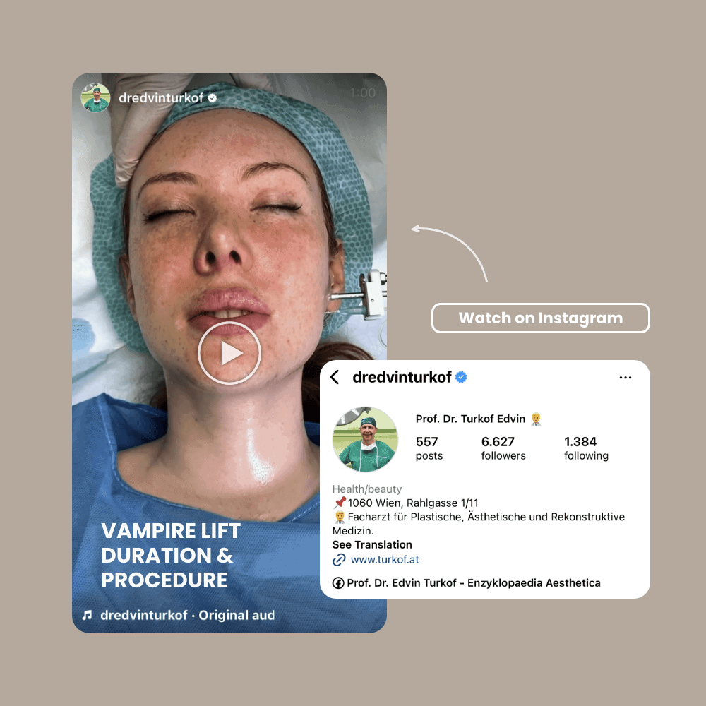 Medizinischer Vampirlift bei Dr. Turkof für Hautverjüngung und Ästhetik.
