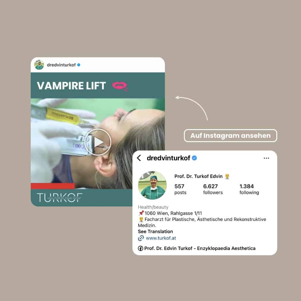 Medizinische Vampirlift-Behandlung bei Turkof, ästhetische Gesichtsverjüngung.