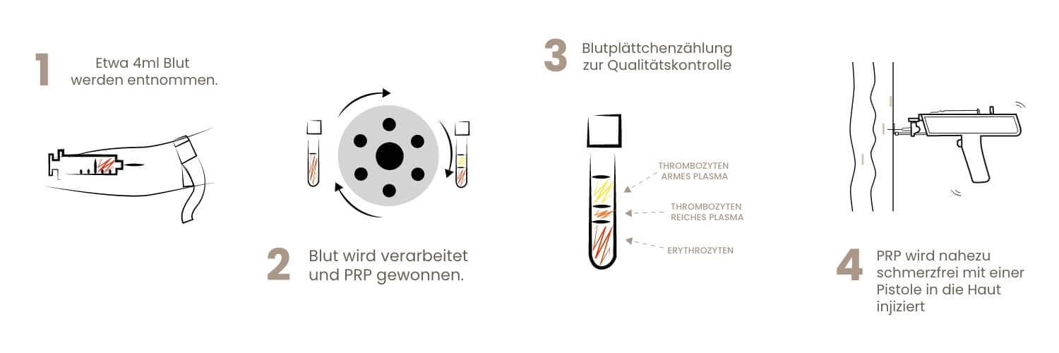 Diagram showing blood collection, processing, and injection steps.
