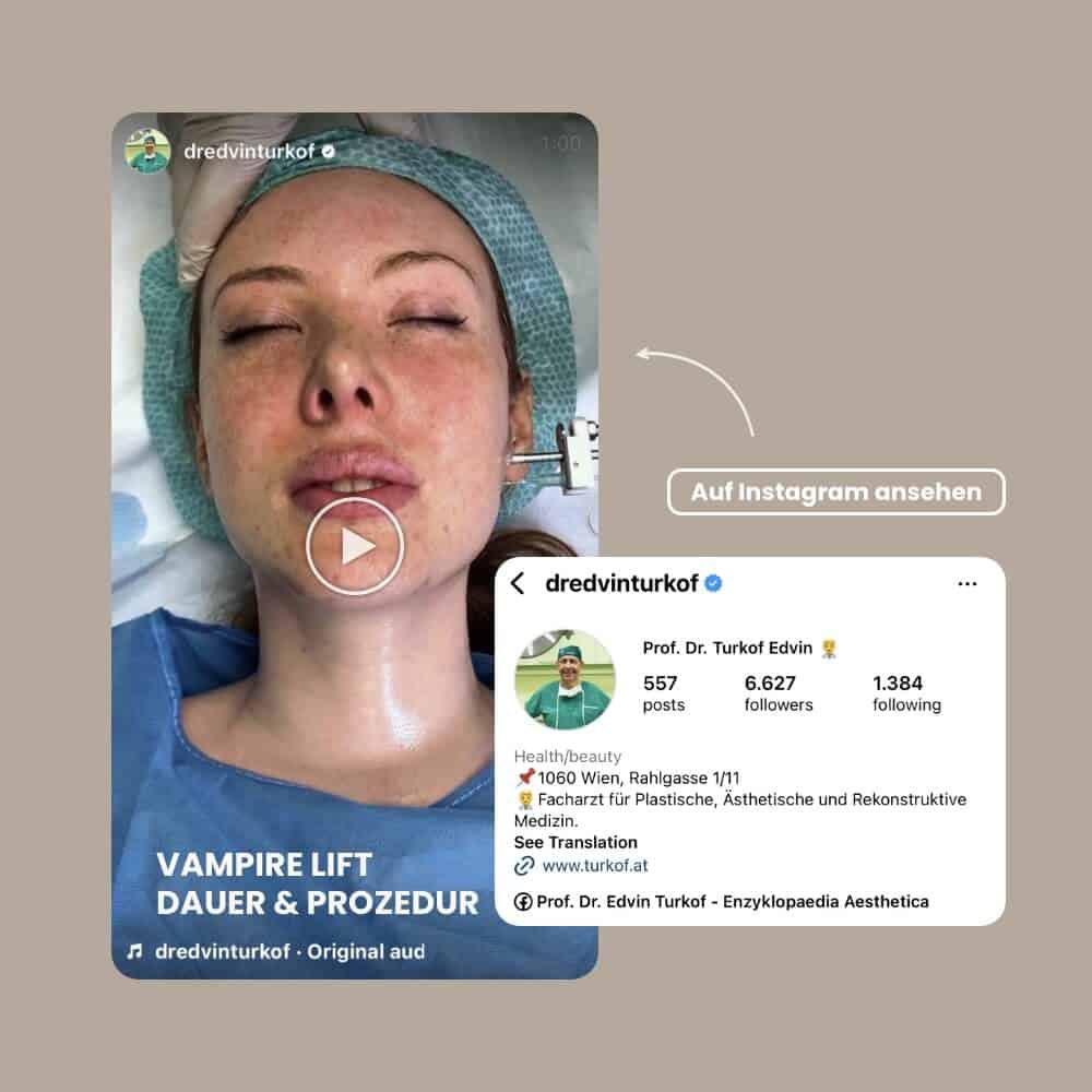 Frau nach Vampirlift-Behandlung, medizinisches Eingreifen.