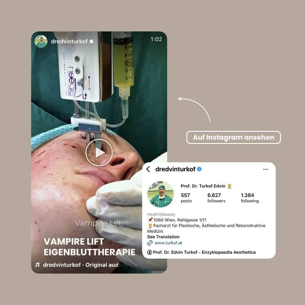 Vampir-Lift Eigenbluttherapie für Hautverjüngung und Regeneration.