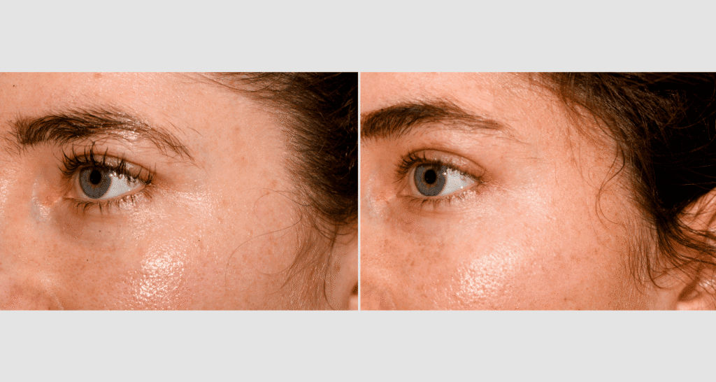 Vergleich der Haut vor und nach Hautpflegebehandlung, sichtbare Verbesserung der Hautstruktur.