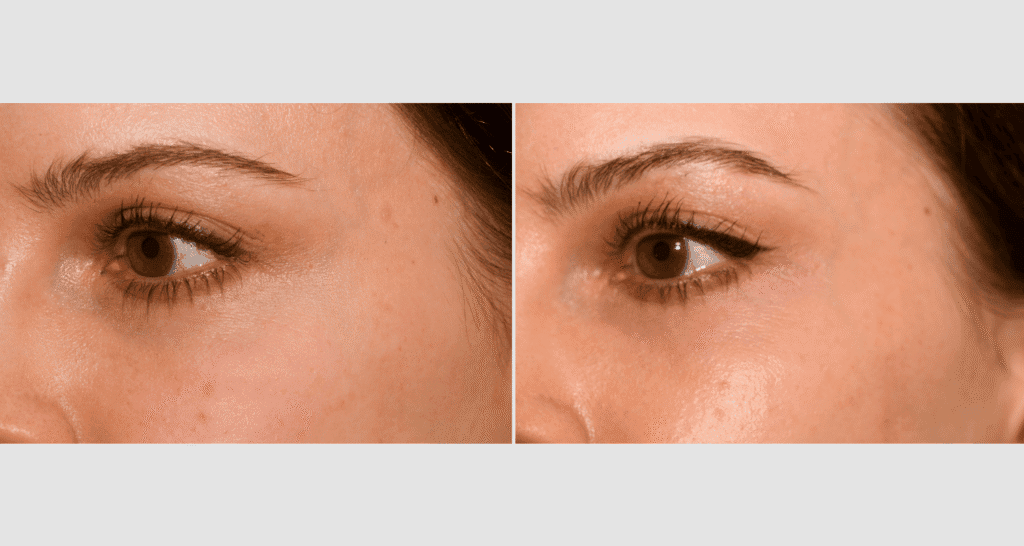 Nahaufnahme der Haut um die Augen mit Fokus auf Hautpflege und Feuchtigkeitsversorgung.