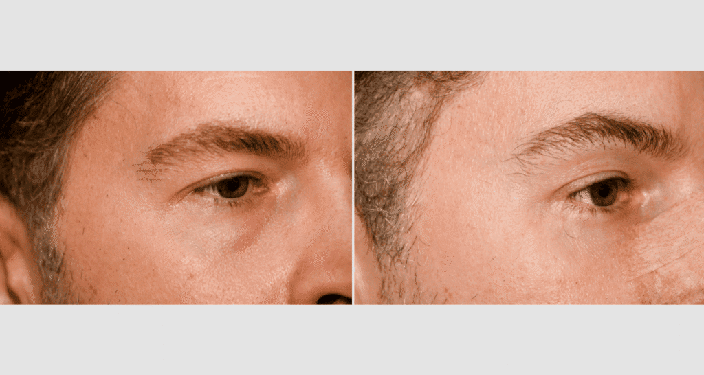 Vergleich der Haut vor und nach der Hautpflegebehandlung.