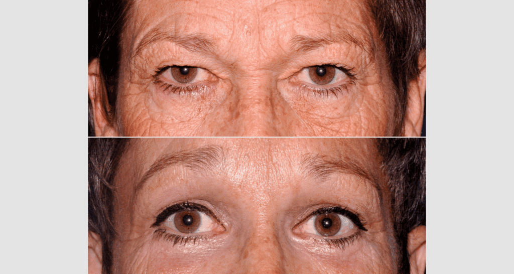 Alternde Haut und Augen, Hautpflege, Anti-Aging, Gesichtspflege, natürliche Schönheit, Hautgesundheit, Gesichtsuntersuchung, Hautanalyse, Hautpflege-Tipps, Schönheitspflege