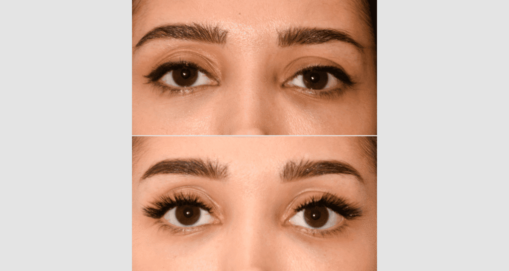 Nahaufnahme von Augenbrauen vor und nach der Pflege, Fokus auf Hautverbesserung.