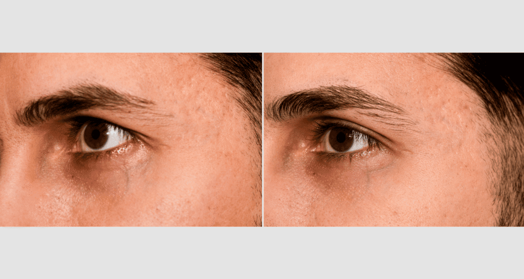 Nahaufnahme eines männlichen Auges mit gepflegter Haut und Bart.