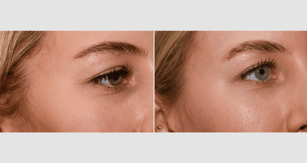 Vorher-Nachher Vergleich der Hautpflege bei Turkof.at.