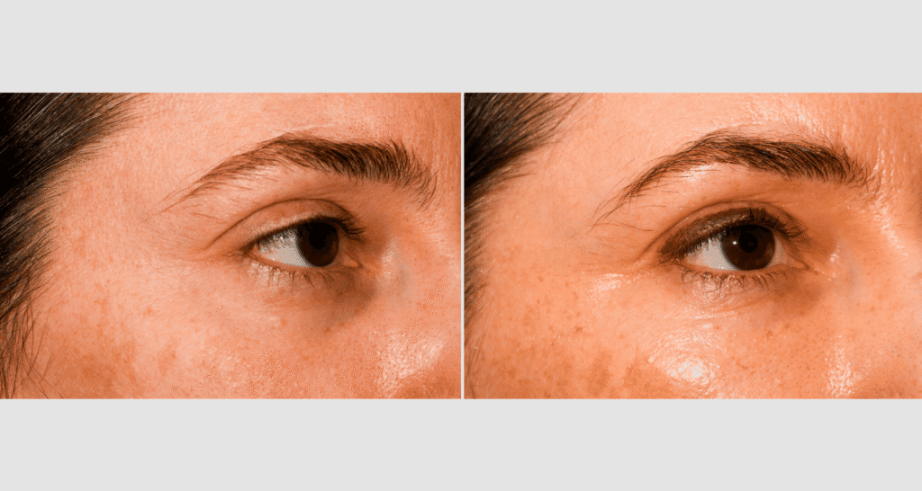 Vergleich der Haut vor und nach einer Hautpflegebehandlung.