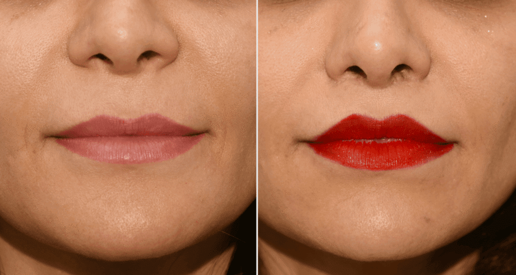 Vorher/Nachher Ergebnis: Bullhorn Lift