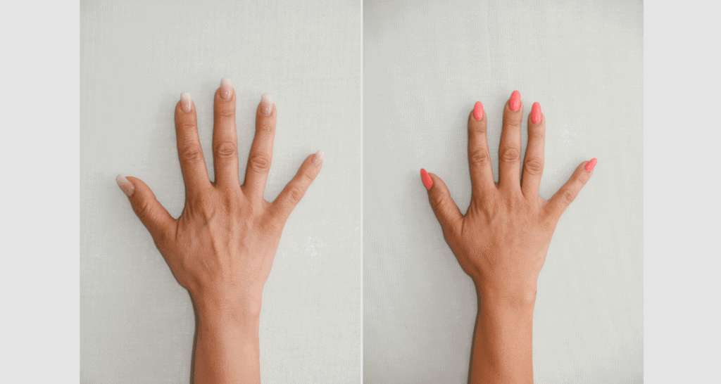 Vorher/Nachher Ergebnis: Eigenfett Haende