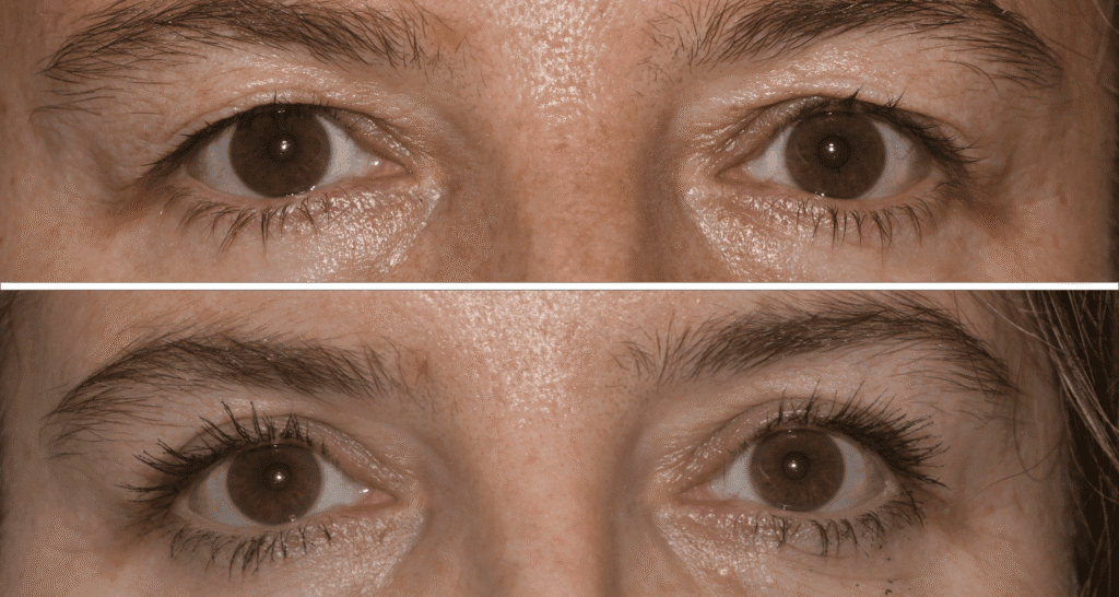 Vergleich der Haut vor und nach einer Hautbehandlung, Fokus auf Verbesserung der Hautqualität.