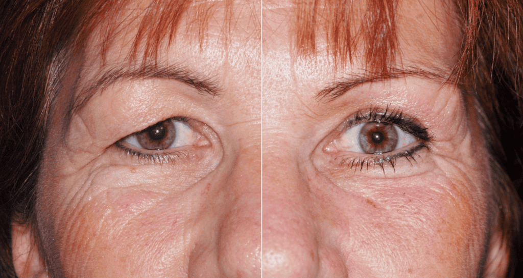 Nahaufnahme eines Gesichts mit sichtbaren Hautalterungszeichen, Hautpflege, Anti-Aging.