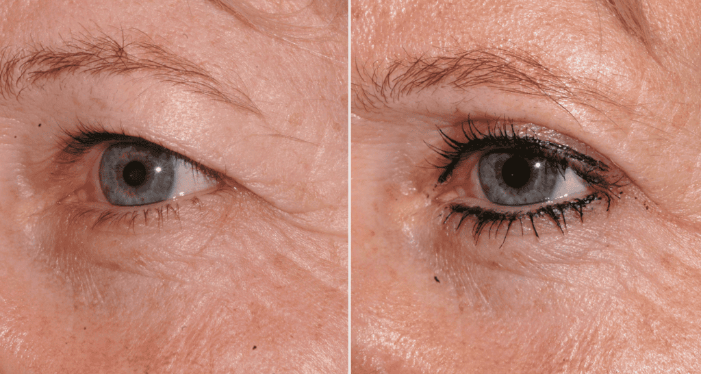 Vergleich der Haut vor und nach der Hautpflegebehandlung.