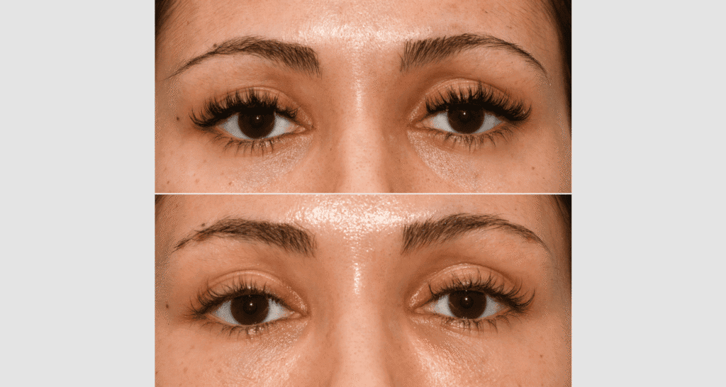 Nahaufnahme von Wimpern vor und nach der Verlängerung, detaillierte Sicht.