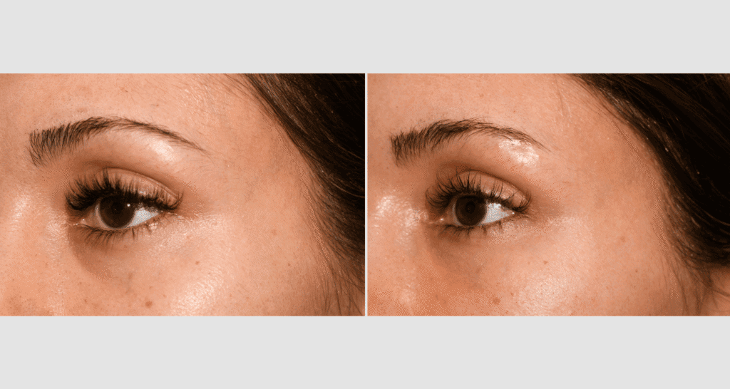 Vergleich der Haut vor und nach Hautpflegebehandlung, sichtbare Verbesserung der Hautstruktur.