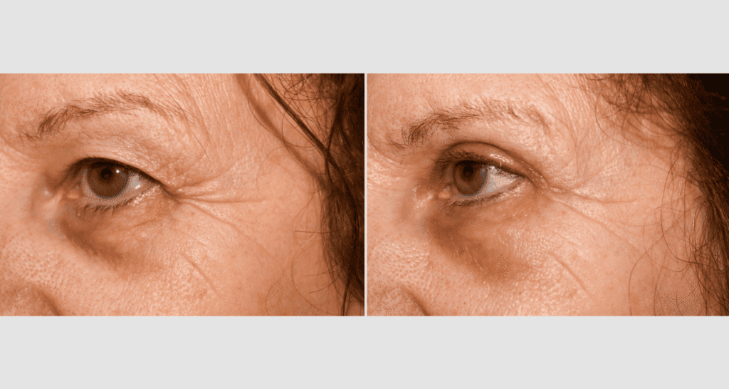 Nahaufnahme eines menschlichen Auges mit sichtbaren Hautalterungen und Falten.