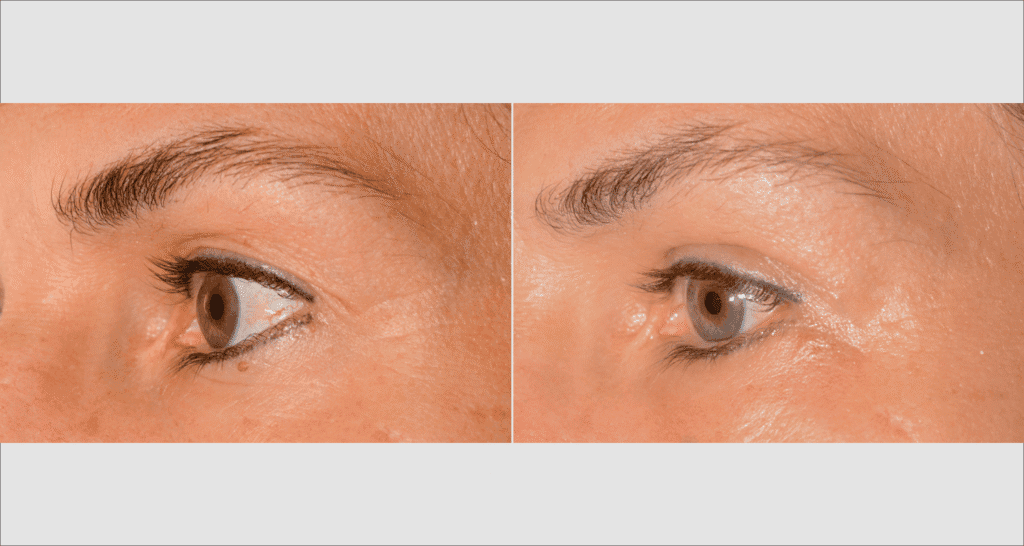 Nahaufnahme der Haut um das Auge, Hautpflege und Feuchtigkeitsversorgung.