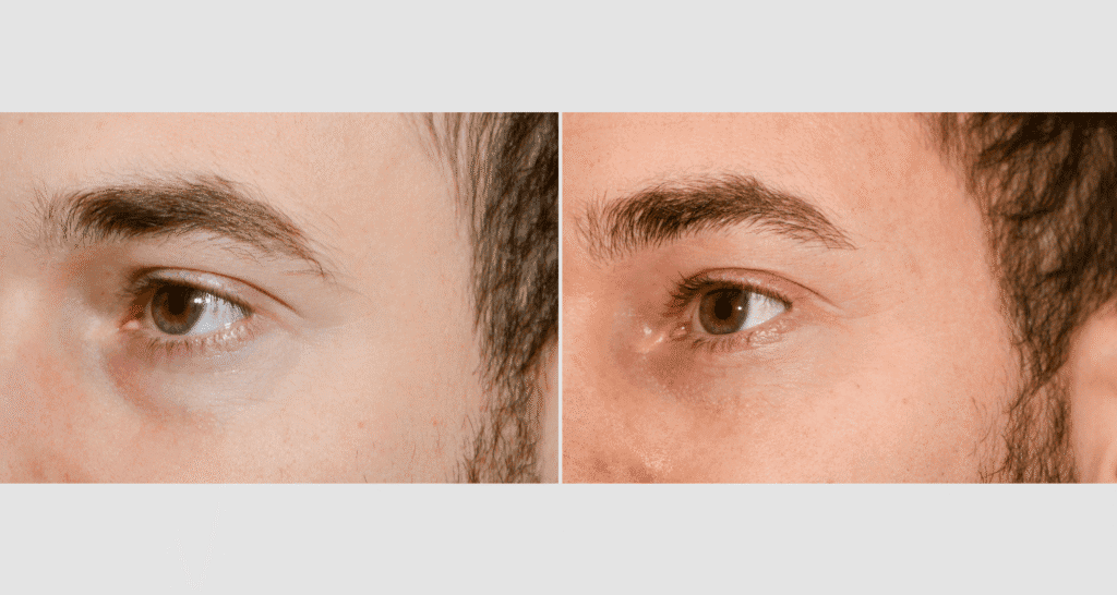 Vergleich der Haut vor und nach der Hautpflegebehandlung.