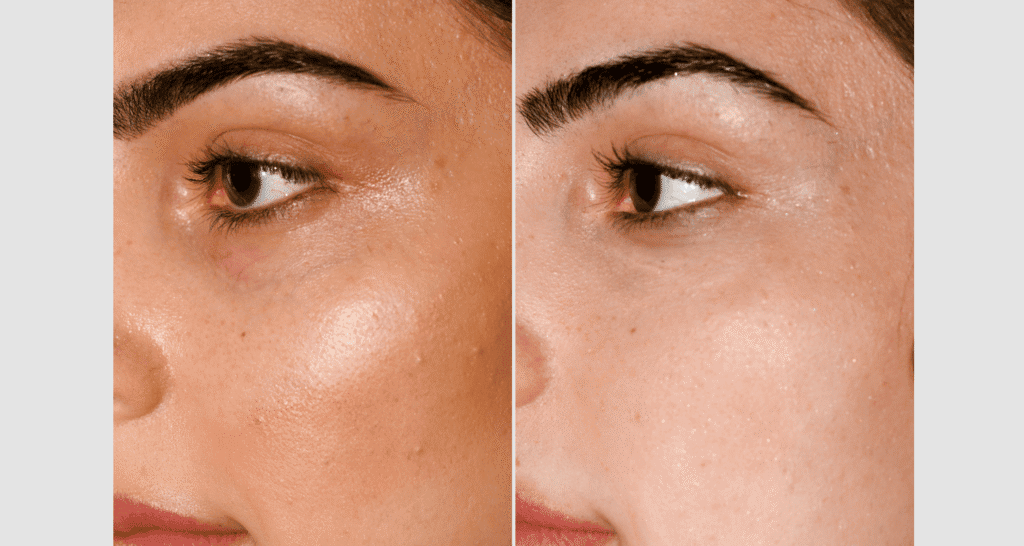 Hautpflege vor und nach der Behandlung, Hautbildverbesserung, Hautreinigung, Hautpflege, kosmetische.