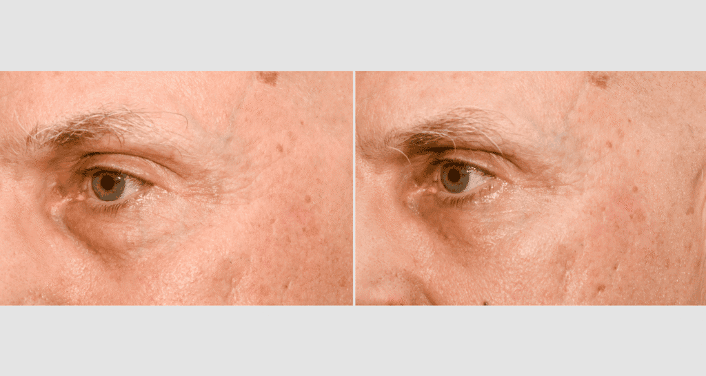 Nahaufnahme der Haut um das Auge, Hautpflege und Anti-Aging.