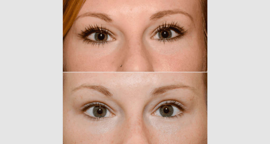 Vergleich der Haut vor und nach der Hautpflegebehandlung.